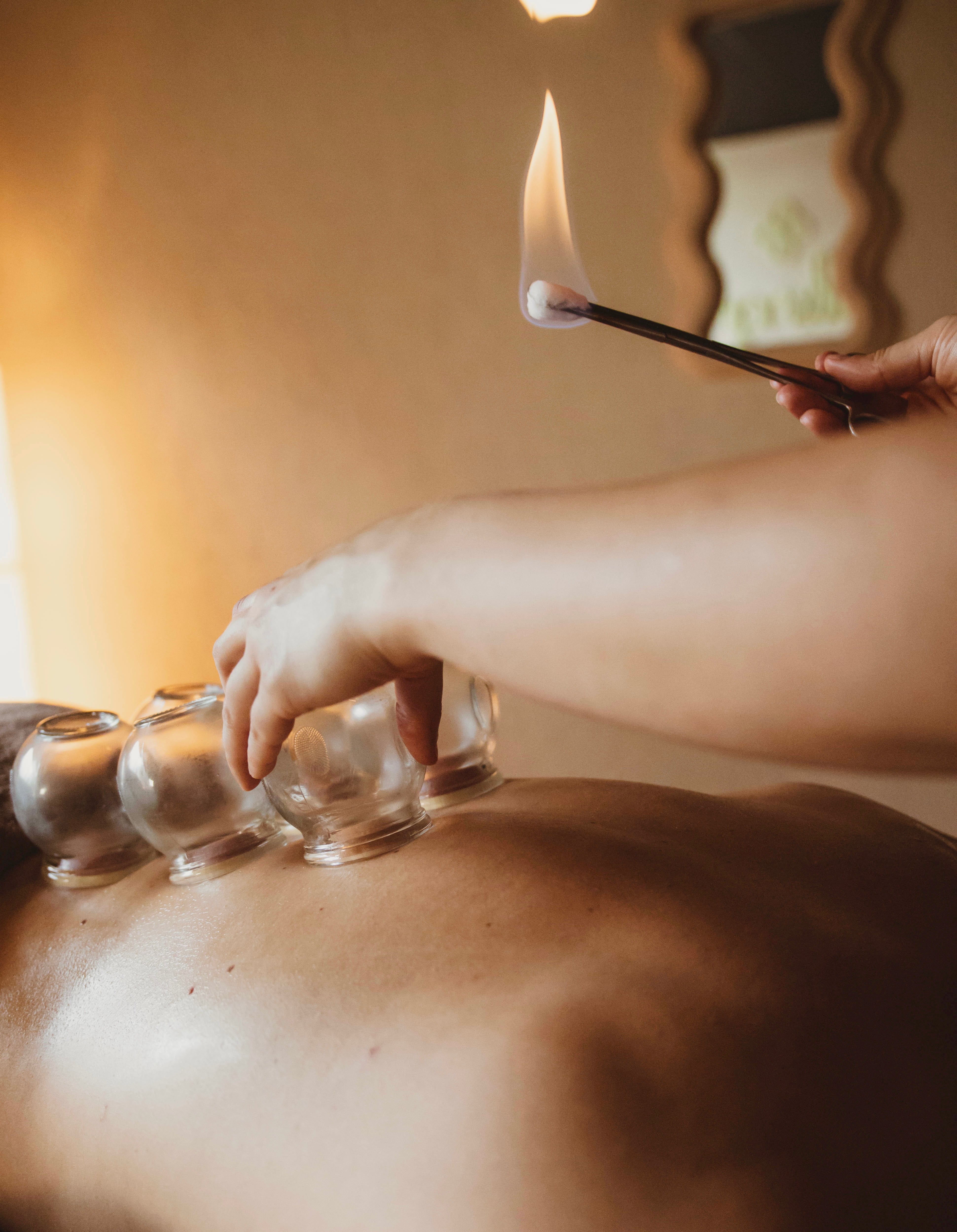Cupping behandeling: hoe werkt het en wat zijn de effecten?